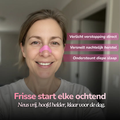 Roze Nose Strips - Classic