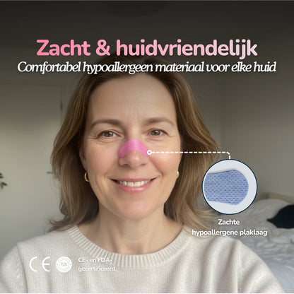 Roze Nose Strips - Classic