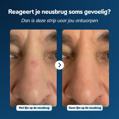 Nasal Strips | For Sensitive Skin